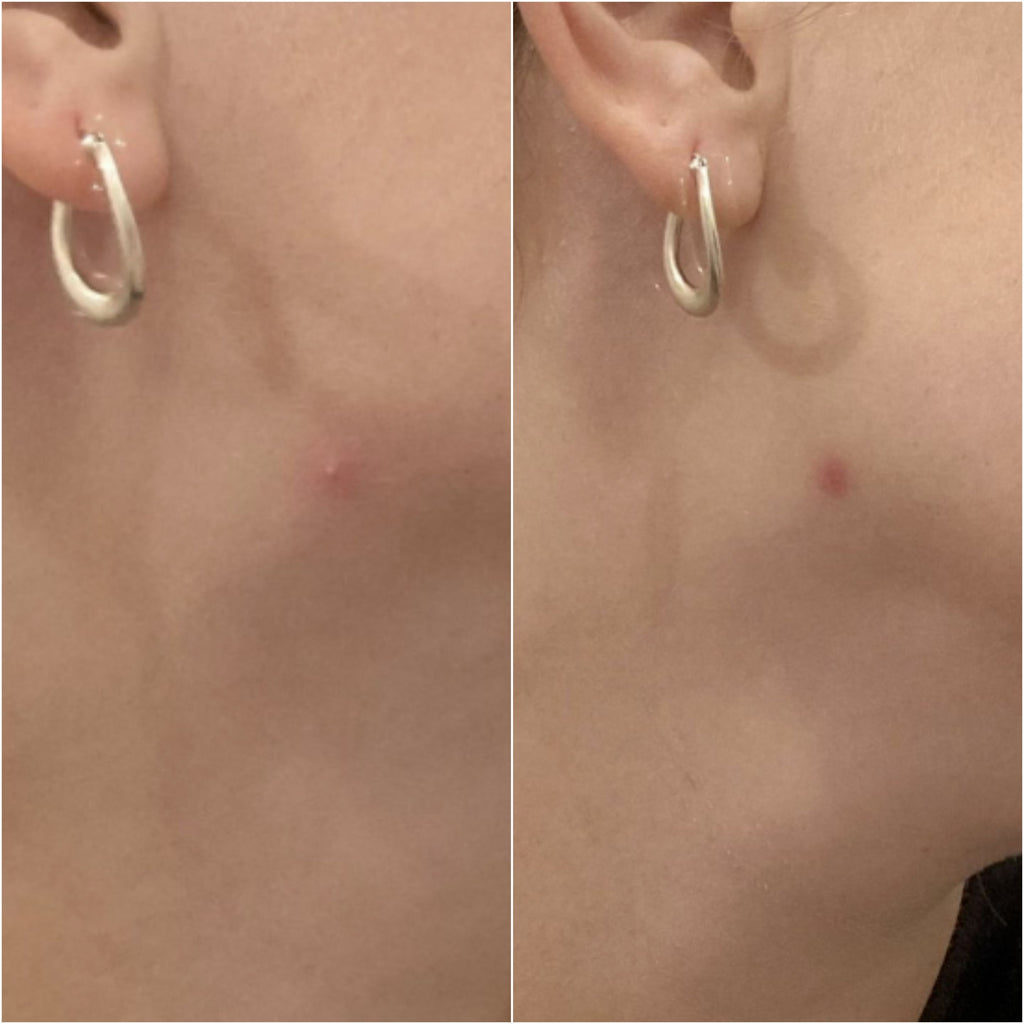 Breakout Classic Before_After 1 Skin Choice