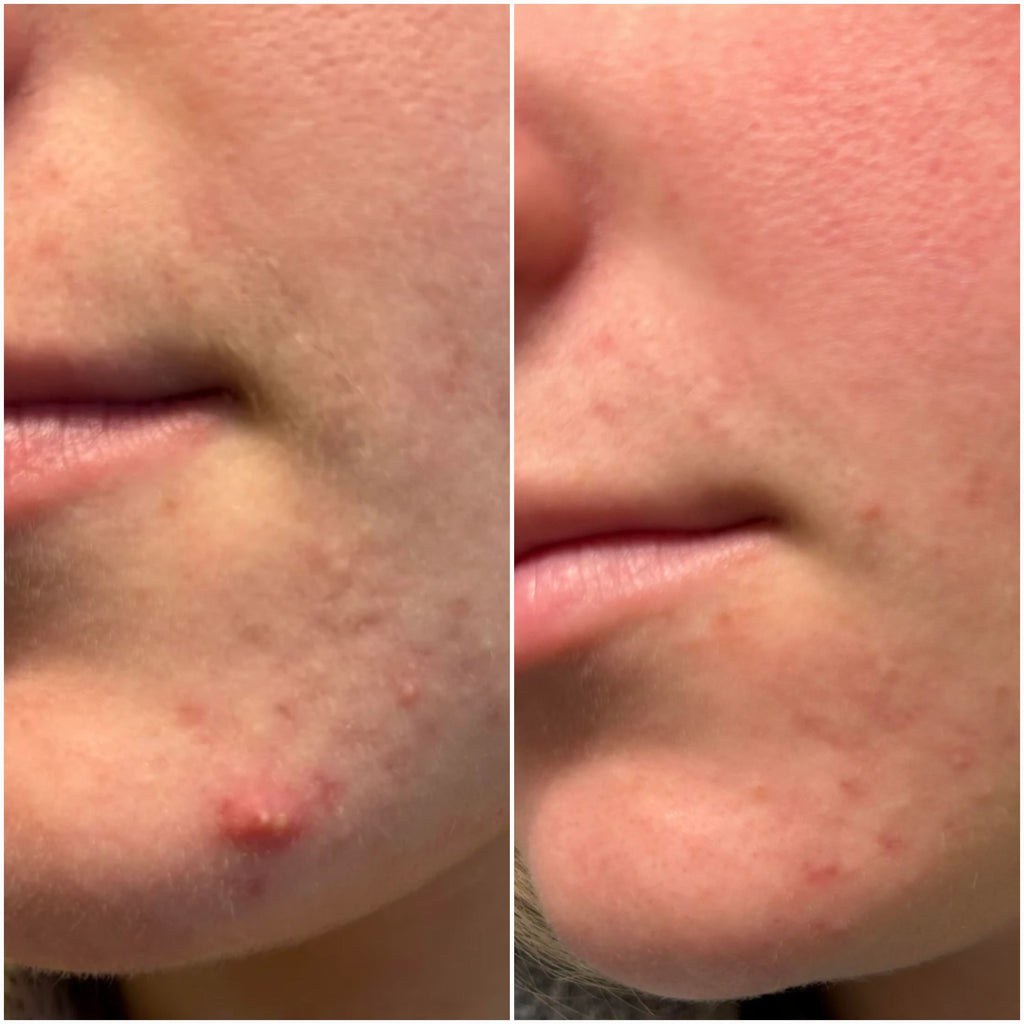 Breakout Classic Before_After 2 Skin Choice
