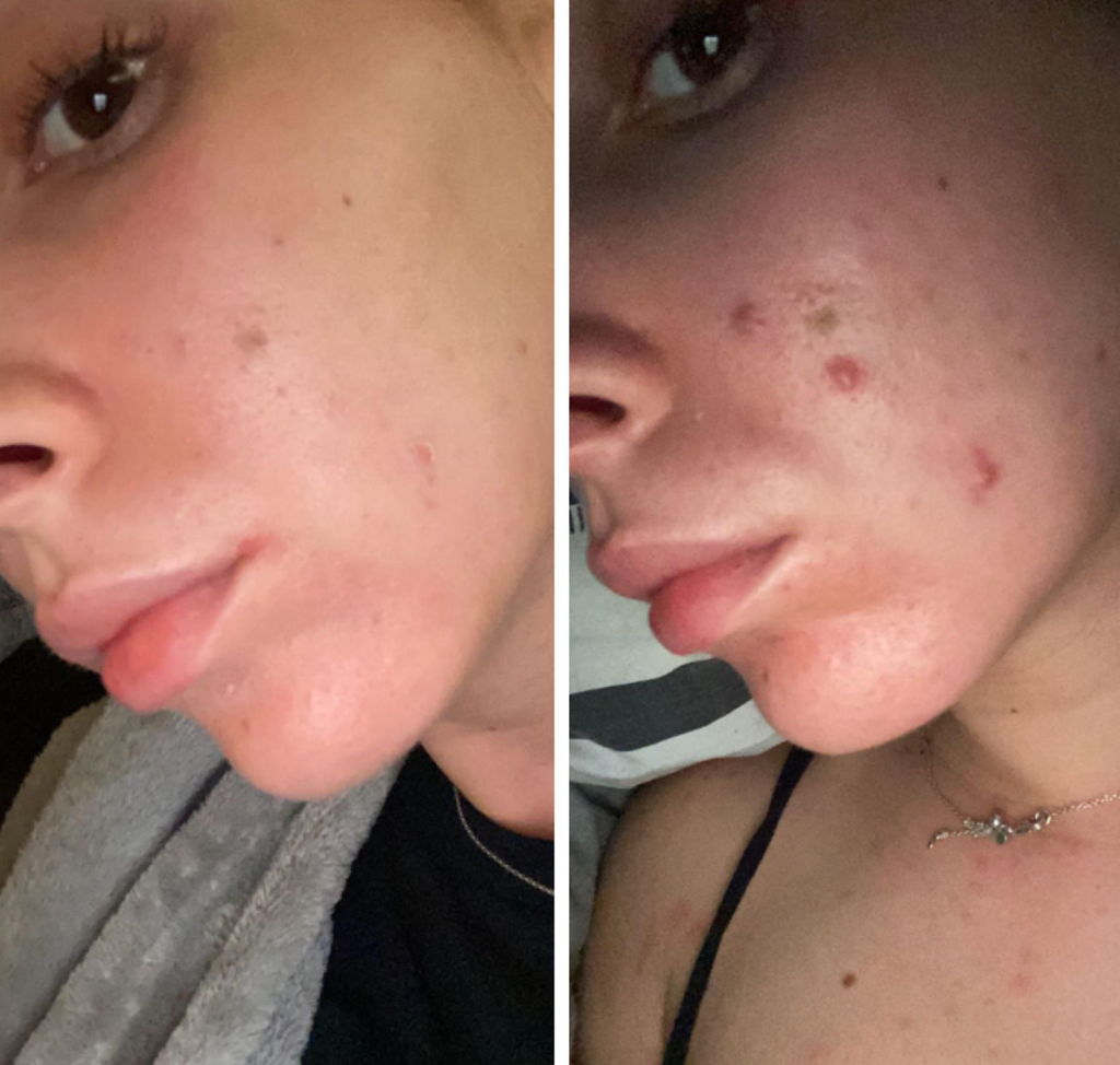 Breakout Classic Before_After 4 - Skin Choice