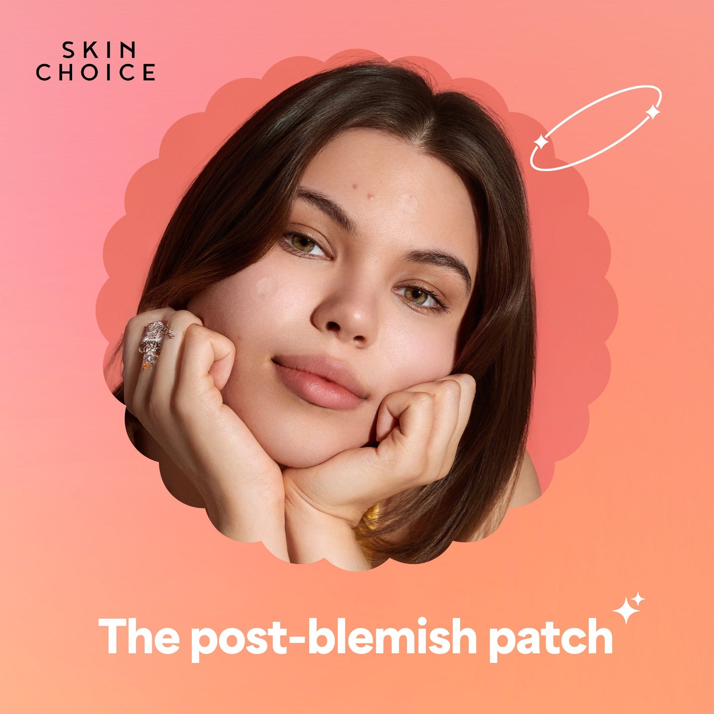 Classic Blemish Trio.