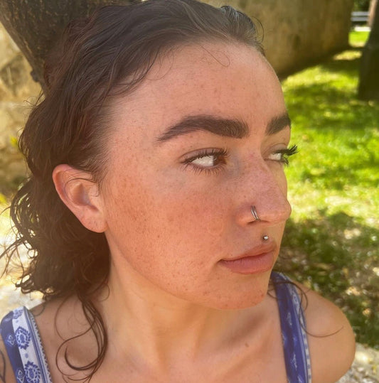 How Wearing Pimple Patches in Public Became the Ultimate Skincare Power Move - Skin Choice