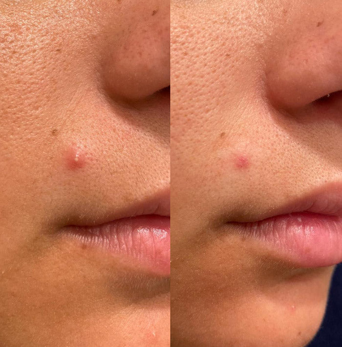Breakout Classic Before_After 3 Skin Choice