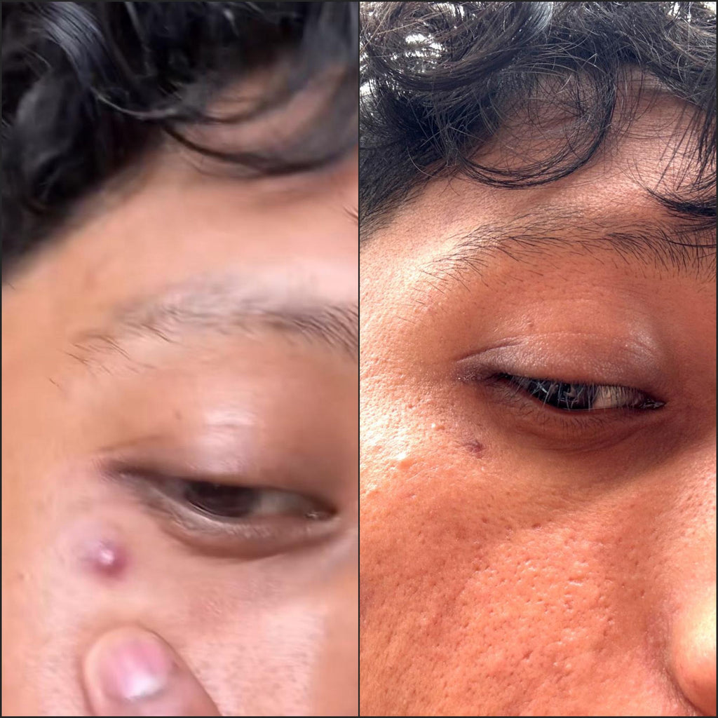 Breakout Classic Dart (Before & After) 1 - Skin Choice 