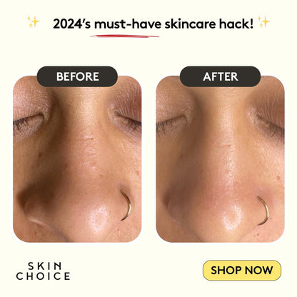 Pore Patches Duo.